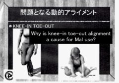 knee in 1